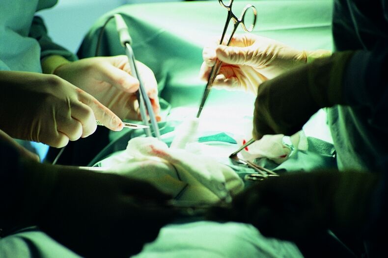 penis kalınlığında cerrahi artış